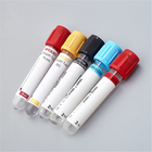 1-10 مللي أنابيب جمع الدم فراغ K3 عينة الدم أنبوب EDTA