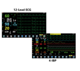 معدات مراقبة التخدير المحمولة محلل الأكسجين TFT 15.6 &quot;LCD